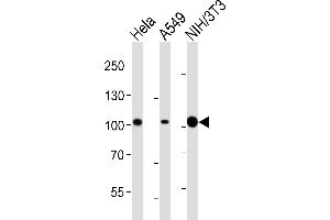 Western blot analysis of lysates from Hela, A549, mouse NIH/3T3 cell line (from left to right), using FER Antibody (ABIN6243360 and ABIN6577092). (FER 抗体  (AA 1-300))