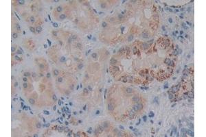 Immunohistochemistry (IHC) image for anti-Nitric Oxide Synthase Trafficker (NOSTRIN) (AA 18-251) antibody (ABIN7432253)