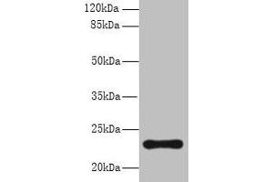 Western blot All lanes: AP3S2 antibody at 6 μg/mL + A549 whole cell lysate Secondary Goat polyclonal to rabbit IgG at 1/10000 dilution Predicted band size: 23, 44, 15 kDa Observed band size: 23 kDa (AP3S2 抗体  (AA 1-193))