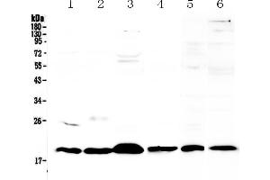 Western blot analysis of ICOS using anti-ICOS antibody . (ICOS 抗体  (AA 21-200))