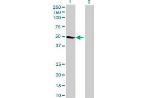 Western Blot analysis of ZNF718 expression in transfected 293T cell line by ZNF718 MaxPab polyclonal antibody. (ZNF718 抗体  (AA 1-478))