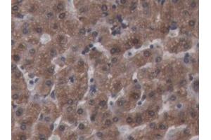 Immunohistochemistry (IHC) image for anti-Ferritin, Heavy Polypeptide 1 (FTH1) (AA 1-181) antibody (ABIN7440041)