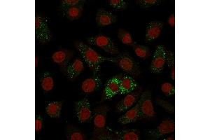 Immunofluorescence Analysis of A549 cells labeling MVP with MVP Monoclonal Antibody (Clone 1014) followed by Goat anti-Mouse IgG-CF488 (Green). (MVP 抗体)