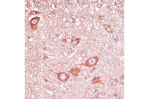 Immunohistochemistry (IHC) image for anti-Ribosomal Protein L32 (RPL32) (AA 1-135) antibody (ABIN6147138)