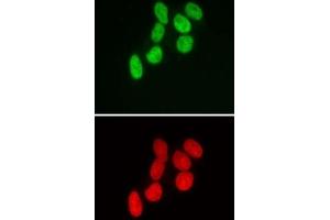 SMARCB1 antibody (mAb) (Clone 2C2) tested by immunofluorescence. (SMARCB1 抗体)