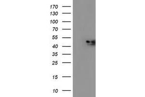 HEK293T cells were transfected with the pCMV6-ENTRY control (Left lane) or pCMV6-ENTRY C2orf56 (Right lane) cDNA for 48 hrs and lysed. (NDUFAF7 抗体)