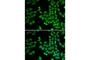 Immunofluorescence analysis of MCF-7 cells using PTPN1 antibody (ABIN5970769). (PTPN1 抗体)