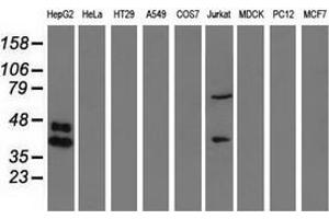 Western blot analysis of extracts (35 µg) from 9 different cell lines by using anti-HP monoclonal antibody. (Haptoglobin 抗体)