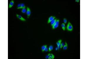 Immunofluorescence staining of HepG2 cells with ABIN7145704 at 1:333, counter-stained with DAPI. (BMPR1A 抗体  (AA 177-532))