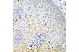 Immunohistochemistry (Paraffin-embedded Sections) (IHC (p)) image for anti-Myosin 9 (MYH9) (AA 1711-1960) antibody (ABIN1513234)