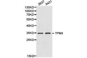 Western Blotting (WB) image for anti-Tropomyosin 3 (TPM3) antibody (ABIN1875182) (TPM3 抗体)