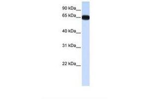 Image no. 1 for anti-Distal-Less Homeobox 4 (DLX4) (AA 38-87) antibody (ABIN6737752) (DLX4 抗体  (AA 38-87))