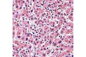 ALP antibody immunohistochemistry analysis in formalin fixed and paraffin embedded human liver tissue. (Alkaline Phosphatase 抗体  (AA 282-309))