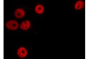 ABIN6274305 staining Hela cells by IF/ICC. (SSBP2 抗体  (N-Term))
