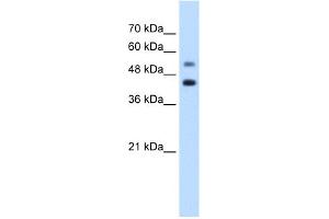 WB Suggested Anti-GTPBP2 Antibody Titration:  1. (GTPBP2 抗体  (C-Term))