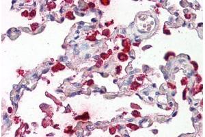 Image no. 2 for anti-Surfactant Protein B (SFTPB) (AA 194-243) antibody (ABIN1493901) (SFTPB 抗体  (AA 194-243))