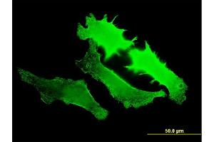 Immunofluorescence of monoclonal antibody to GUCY2D on HeLa cell. (GUCY2D 抗体  (AA 521-630))