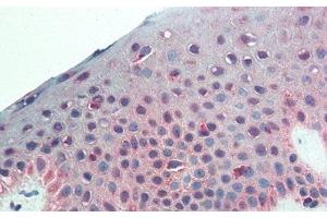Detection of CSPG4 in Human Skin Tissue using Monoclonal Antibody to Chondroitin Sulfate Proteoglycan 4 (CSPG4) (NG2 抗体  (AA 559-776))