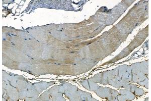 ABIN7093792 and ABIN7097835 at 1/100 staining Mouse skin tissue by IHC-P. (PDLIM3 抗体  (Internal Region))