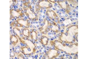 Immunohistochemistry of paraffin-embedded Mouse kidney using UGDH Polyclonal Antibody at dilution of 1:100 (40x lens). (UGDH 抗体)