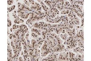 IHC analysis of PC4/SUB1 using anti-PC4/SUB1 antibody (ABIN7602185).