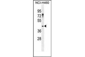 Western blot analysis of GAS1 Antibody (N-term) in NCI-H460 cell line lysates (35ug/lane). (GAS1 抗体  (N-Term))