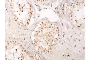 Immunoperoxidase of monoclonal antibody to CRSP6 on formalin-fixed paraffin-embedded human testis. (MED17 抗体  (AA 551-651))