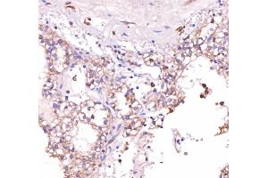 IHC analysis of Acid Phosphatase/ACP5 using anti-Acid Phosphatase/ACP5 antibody (ABIN7601574).