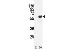 Western Blotting (WB) image for anti-Secreted phosphoprotein 1 (SPP1) (AA 14-40) antibody (ABIN3032521)