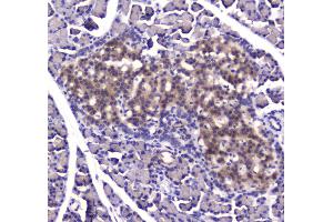 IHC analysis of IDE using anti-IDE antibody . (IDE 抗体  (AA 485-756))