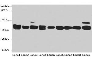 Western blot All lanes: DNAJB1 antibody at 3 μg/mL Lane 1: Mouse spleen tissue Lane 2: Colo320 whole cell lysate Lane 3: Hela whole cell lysate Lane 4: LO2 whole cell lysate Lane 5: HepG2 whole cell lysate Lane 6: HT29 whole cell lysate Lane 7: A549 whole cell lysate Lane 8: Jurkat whole cell lysate Lane 9: MCF-7 whole cell lysate Secondary Goat polyclonal to rabbit IgG at 1/10000 dilution Predicted band size: 39, 28 kDa Observed band size: 39 kDa (DNAJB1 抗体  (AA 1-340))