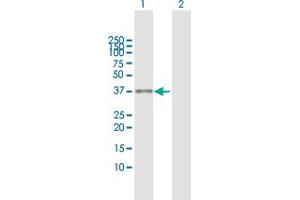 Western Blot analysis of ASPA expression in transfected 293T cell line by ASPA MaxPab polyclonal antibody. (ASPA 抗体  (AA 1-313))