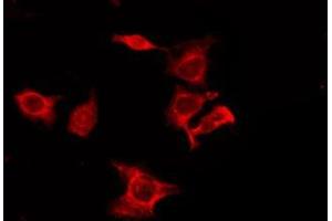 ABIN6275980 staining 293T by IF/ICC. (CNR1 抗体  (N-Term))