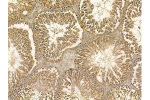 NSUN5 Mouse Monoclonal Antibody at 1/100 staining rat testis tissue by IHC-P.