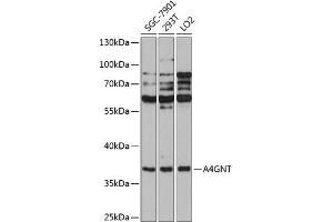 Western blot analysis of extracts of various cell lines, using GNT antibody  at 1:1000 dilution. (A4GNT 抗体  (AA 1-340))