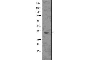 Western blot analysis of TMX2 using K562 whole  lysates. (TMX2 抗体  (N-Term))