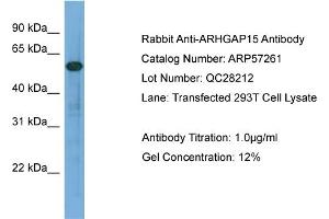 WB Suggested Anti-ARHGAP15  Antibody Titration: 0. (ARHGAP15 抗体  (Middle Region))