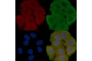 ABIN6258145 and ABIN6273917 staining Hela cells(30 min of UV treatment) by IF/ICC.