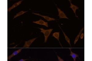 Immunofluorescence analysis of L929 cells using RPL7 Polyclonal Antibody at dilution of 1:100 (40x lens). (RPL7 抗体)