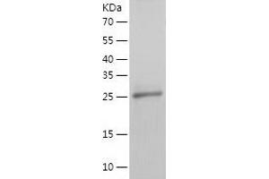 Western Blotting (WB) image for MHC Class I Polypeptide-Related Sequence A (MICA) (AA 24-306) protein (His tag) (ABIN7123952)