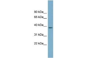 WB Suggested Anti-SDSL Antibody Titration:  0. (SDSL 抗体  (N-Term))