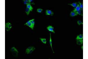 Immunofluorescence staining of HepG2 cells with ABIN7154406 at 1:466, counter-stained with DAPI. (CSF2RA 抗体  (AA 23-320))
