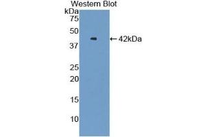 Western Blotting (WB) image for anti-V-Set Domain Containing T Cell Activation Inhibitor 1 (VTCN1) (AA 153-241) antibody (ABIN7440200)