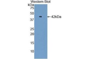 Detection of Recombinant VTCN1, Human using Polyclonal Antibody to V-Set Domain Containing T-Cell Activation Inhibitor 1 (VTCN1) (VTCN1 抗体  (AA 153-241))