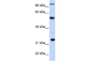 WB Suggested Anti-APOBEC1 Antibody Titration:  0. (APOBEC1 抗体  (N-Term))