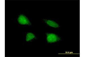 Immunofluorescence of purified MaxPab antibody to C19orf43 on HeLa cell. (C19orf43 抗体  (AA 1-176))