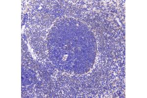 IHC analysis of CD80 using anti-CD80 antibody . (CD80 抗体  (AA 35-244))
