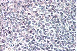 Image no. 2 for anti-Interferon Regulatory Factor 8 (IRF8) antibody (ABIN5868811) (IRF8 抗体)