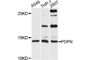 Western blot analysis of extracts of various cell lines, using PDPN antibody (ABIN5974310) at 1/1000 dilution. (Podoplanin 抗体)