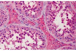 Human Testis, Leydig Cells: Formalin-Fixed, Paraffin-Embedded (FFPE) (APOA2 抗体)